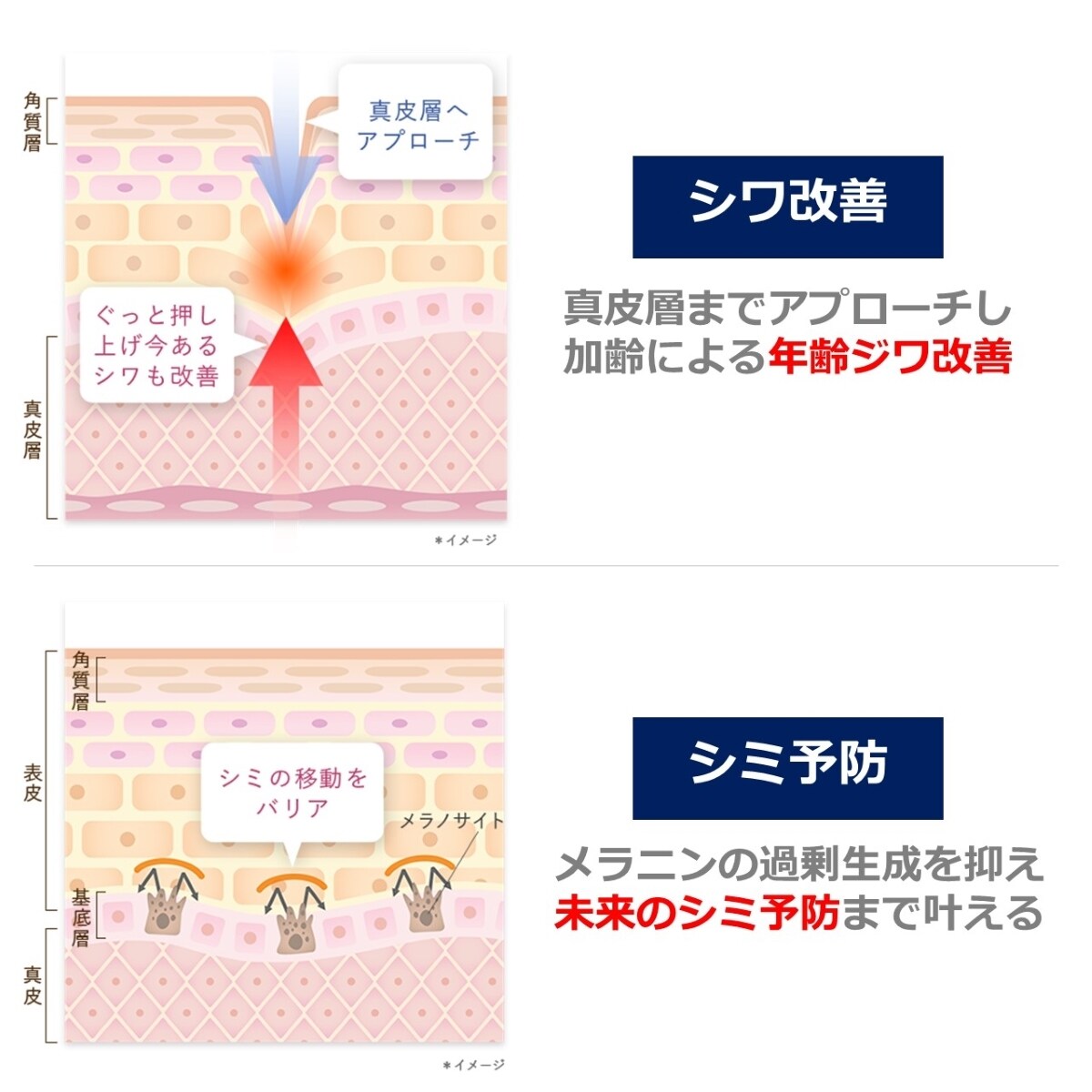 美白＊・シワ改善】コラリッチ リンクルホワイトトーンアップUV
